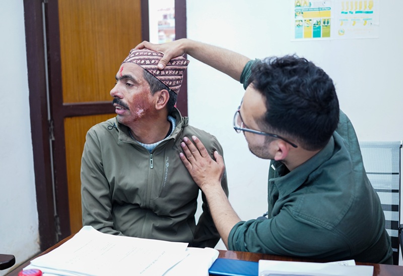 Nabil Free Burn Treatment